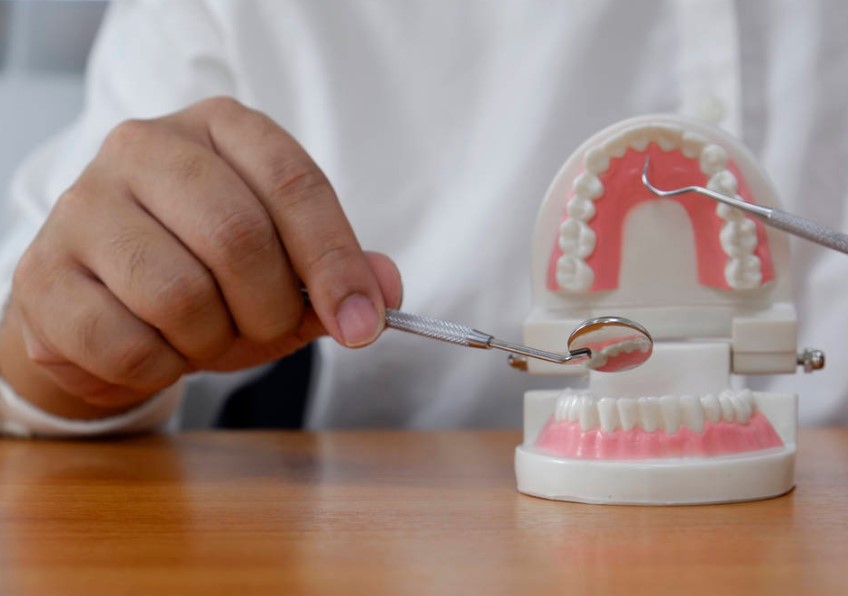 all on 4 dental implantsa